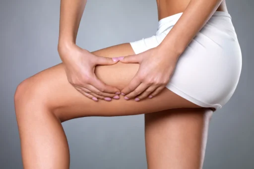 How to get rid of cellulite on legs